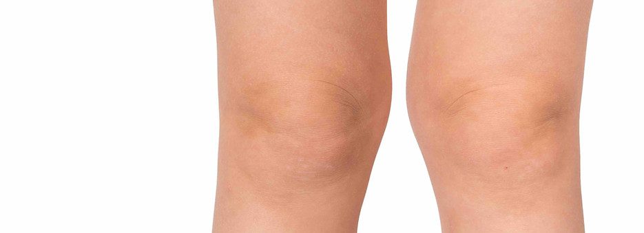 Knee pain Physiotherapy treatment in Kenilworth, Leamington Spa, Warwick, Solihull